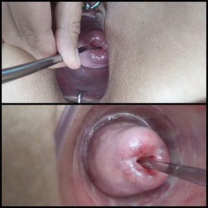 Release 18.08.2016 – Open Cervix with Speculum and Semen Insertion in Uterus – Full HD-1080p, extreme pussy, hardcore fist
