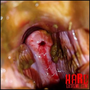 Anna Coprofield – Shit and Blood Vol.5 Speculum Full version – Full HD-1080p, scat defecation, scatology, poop, shit (Release September 20, 2018)